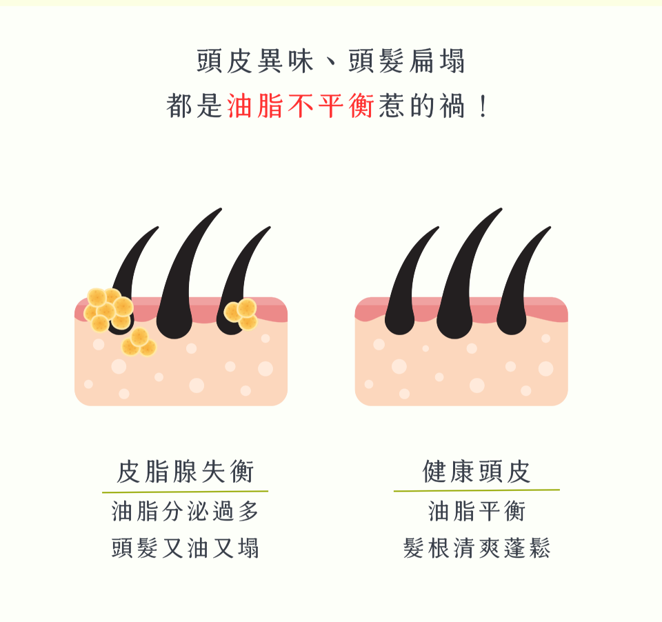 頭皮異味、頭髮扁塌 都是油脂不平衡惹的禍！