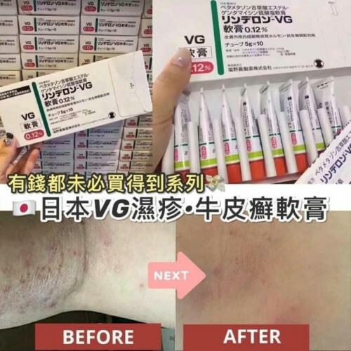 日本VG｜濕疹牛皮癬軟膏 5g