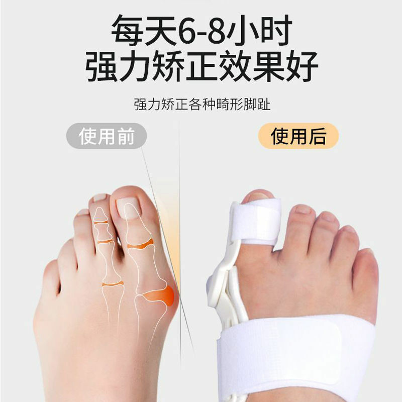 拇指外翻矯正器 (0.3kg)