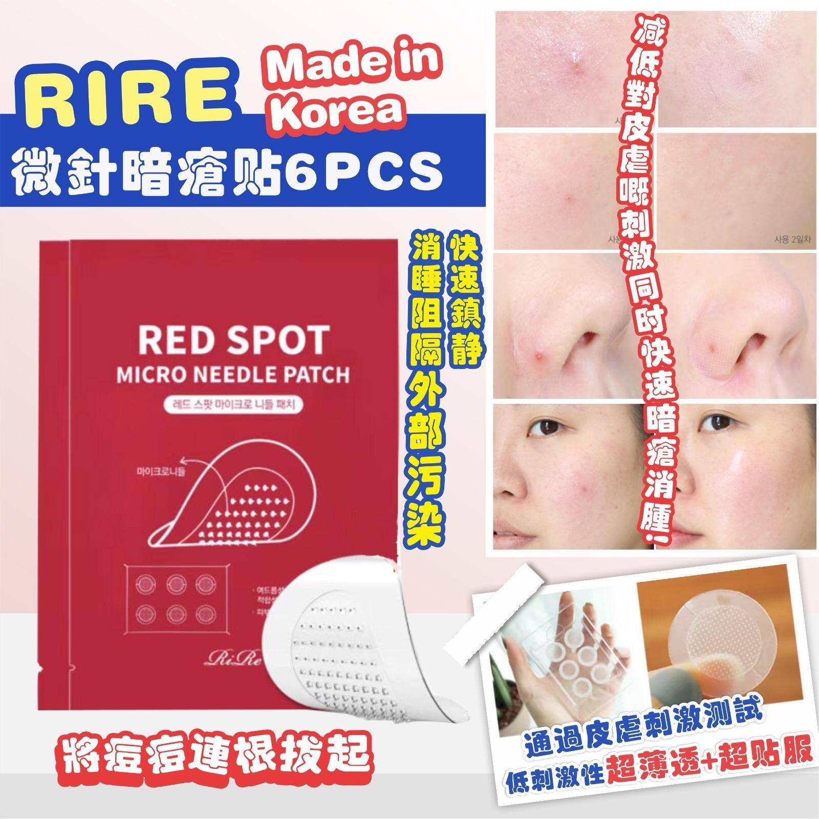 現貨!! 韓國🇰🇷 RIRE 微針暗瘡貼 6PCS