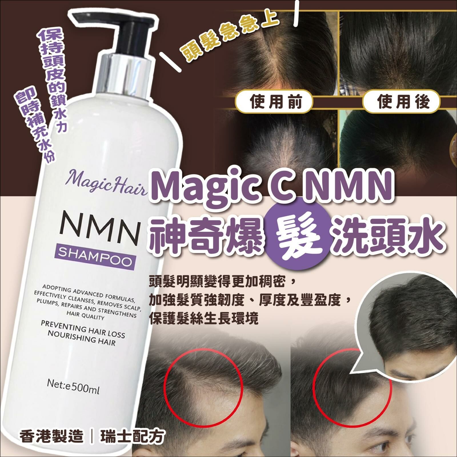 [M1907] [現貨] (K9) Magic C NMN神奇爆髮洗頭水 500ml
