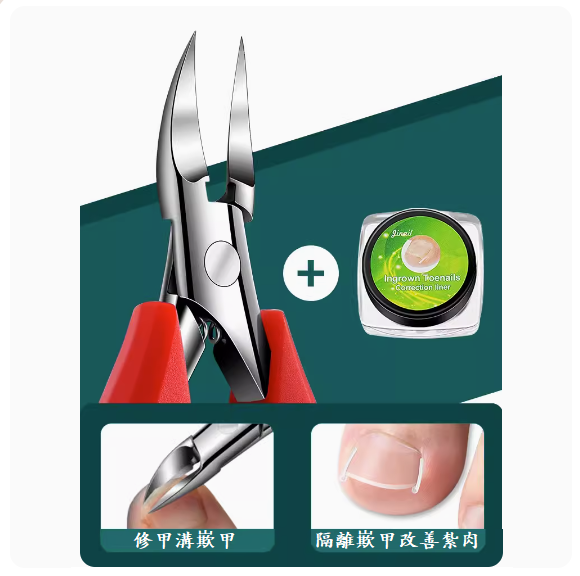 Hot-selling toenail trimming tool (mirror-gloss red nail groove pliers [works better with nail groove filling pad])
