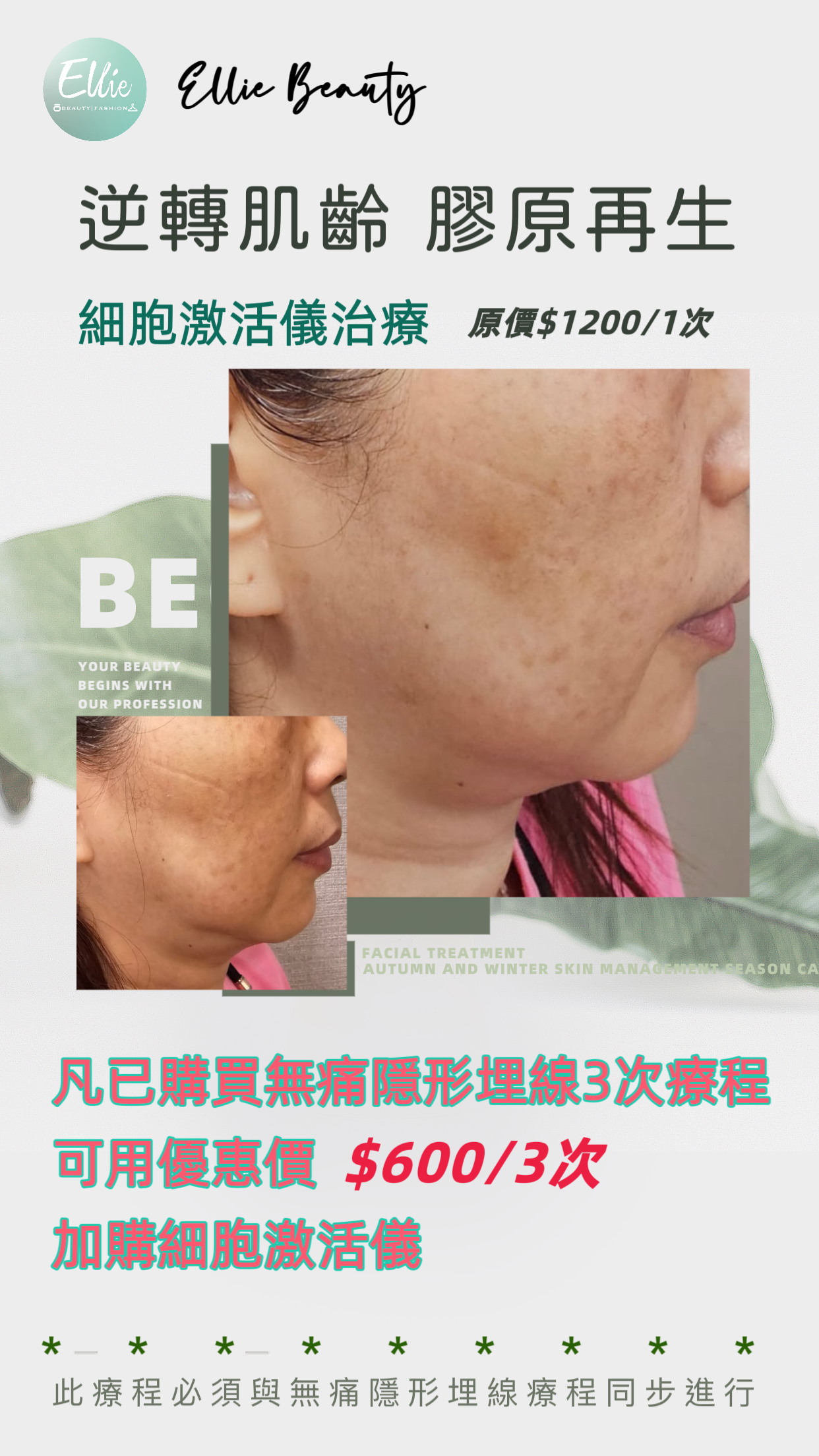 TR09 細胞激活儀 (隱形埋線HIFU加購優惠 此療程不能單獨使用）每人限購3次