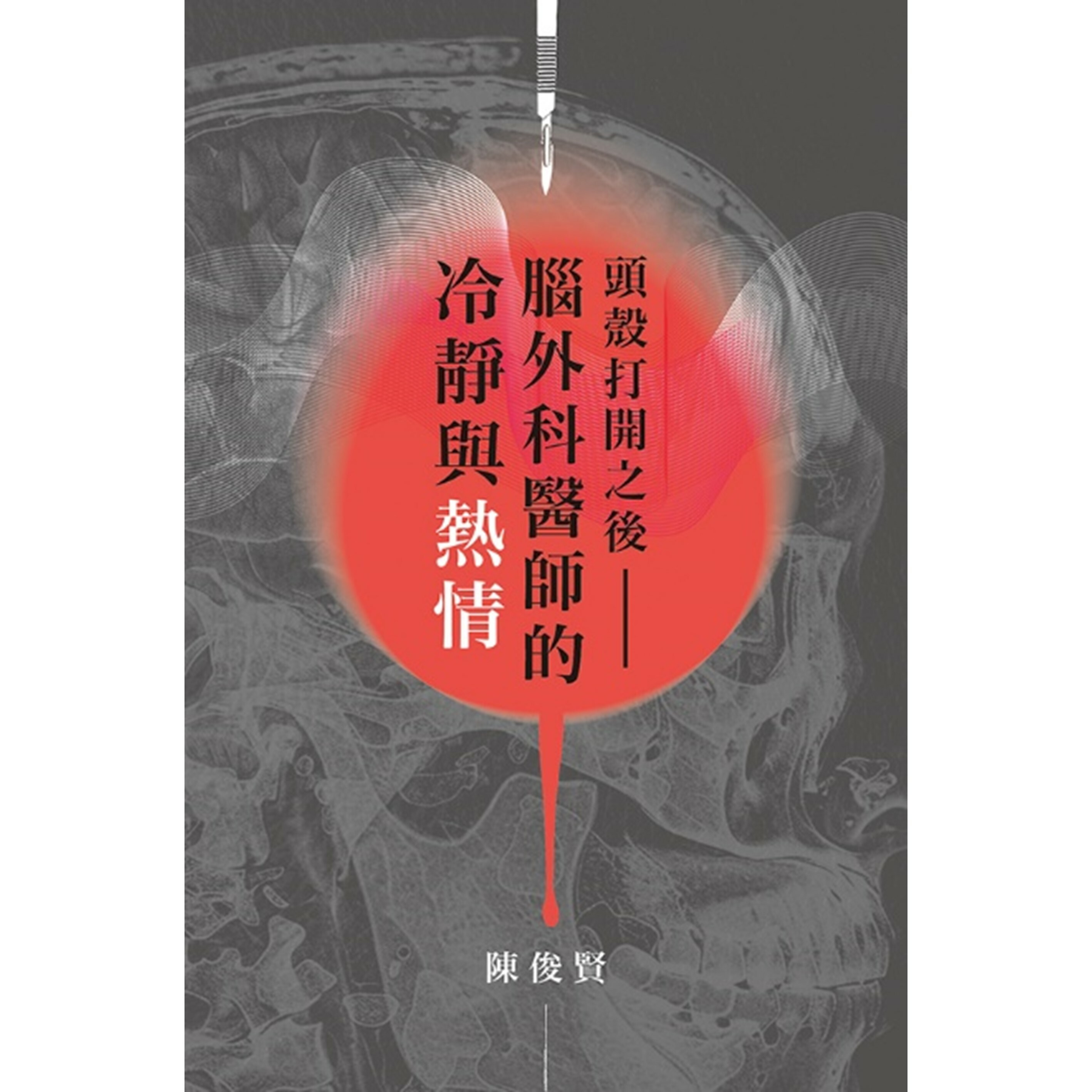 《頭殼打開之後——腦外科醫師的冷靜與熱情》｜陳俊賢 著︱突破出版社
