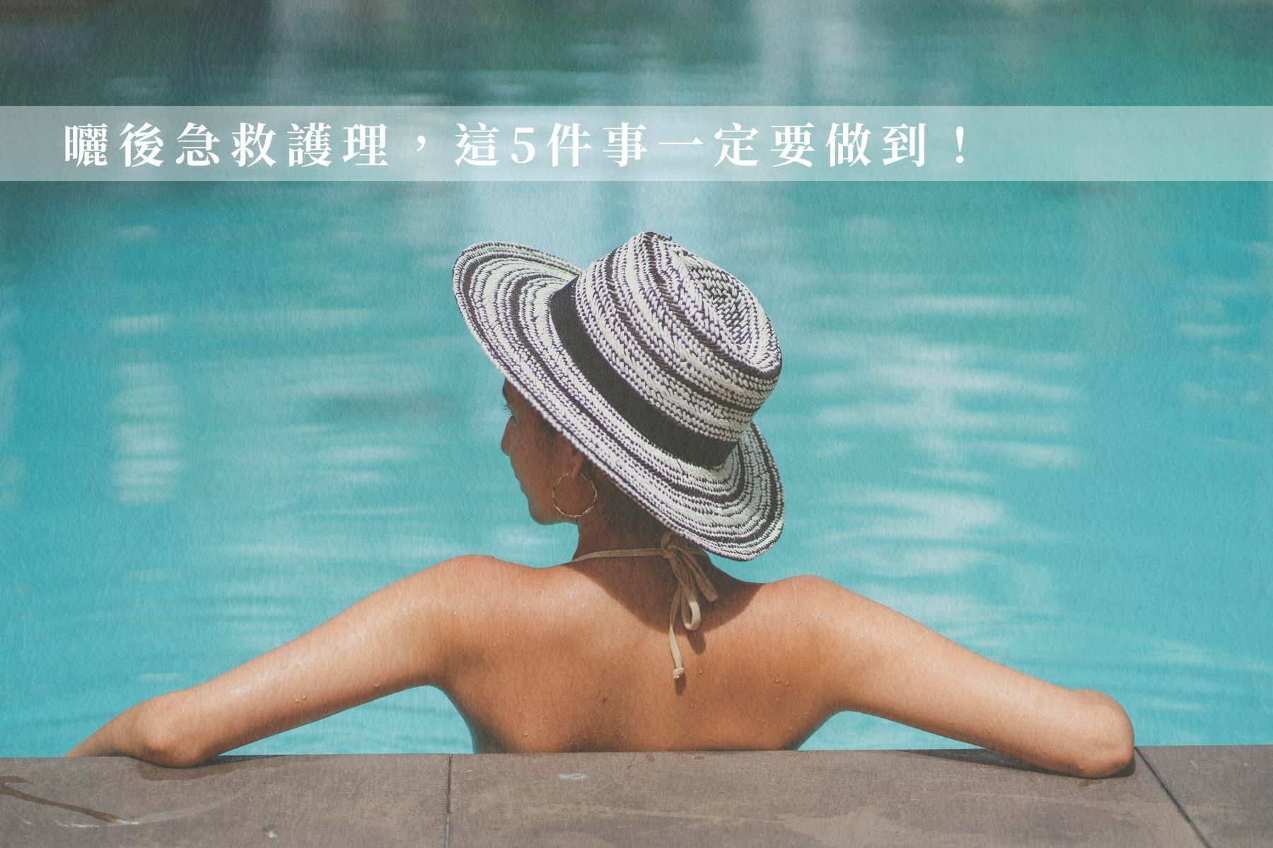 臉部曬傷後可以擦什麼？曬後急救護理，這5件事一定要做到！