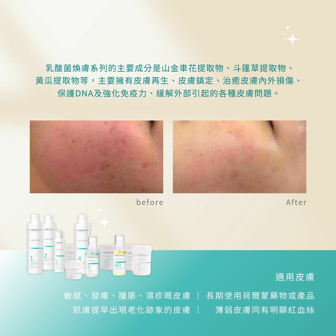 CHRISTINA 乳酸菌舒壓活膚療程