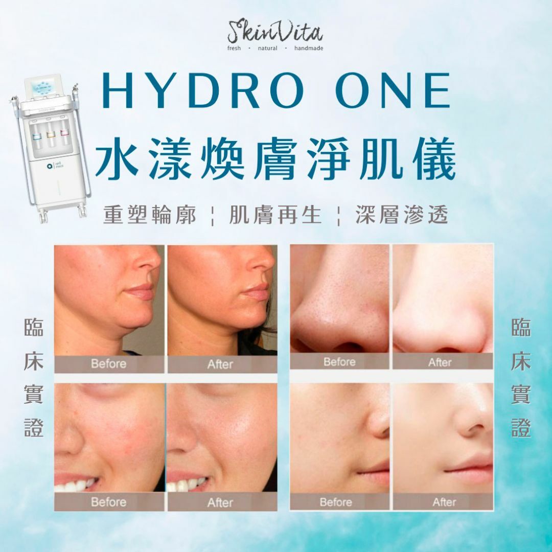Hydro One水漾煥膚淨肌儀療程