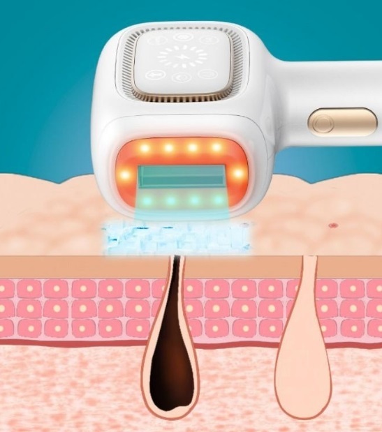 日本Marasil藍寶石冰點無痛脫毛機+SR光子嫩膚功能