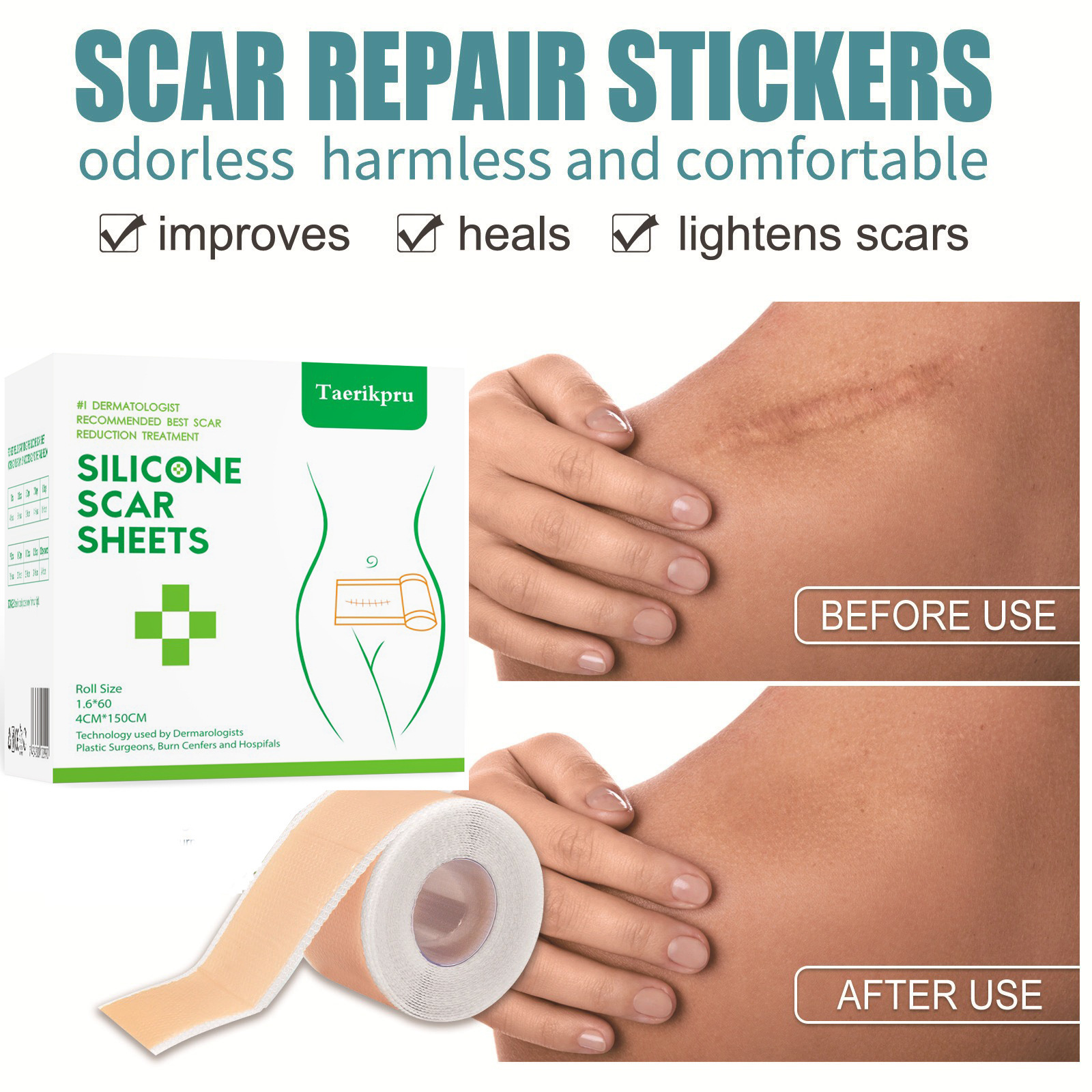 Taerikpru-矽凝膠傷疤痕捲貼 防水淡化 妊娠紋 傷口修護疤痕貼 150CM 自由裁剪 疤痕增生 疤痕贴