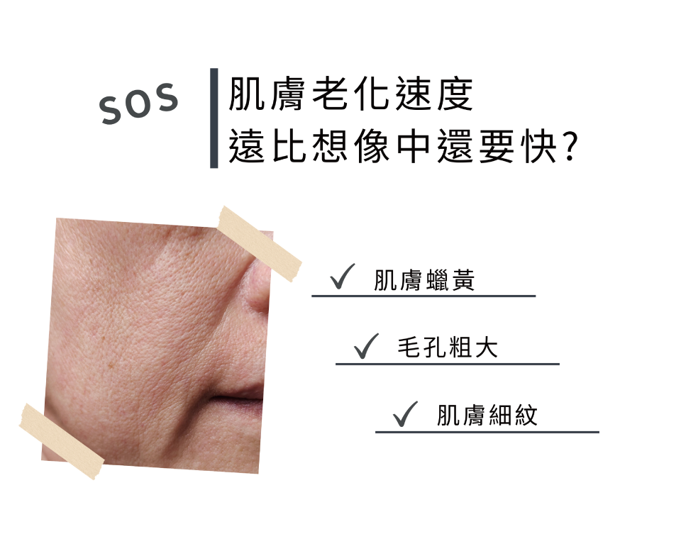 肌膚老化速度 遠比想像中還要快?