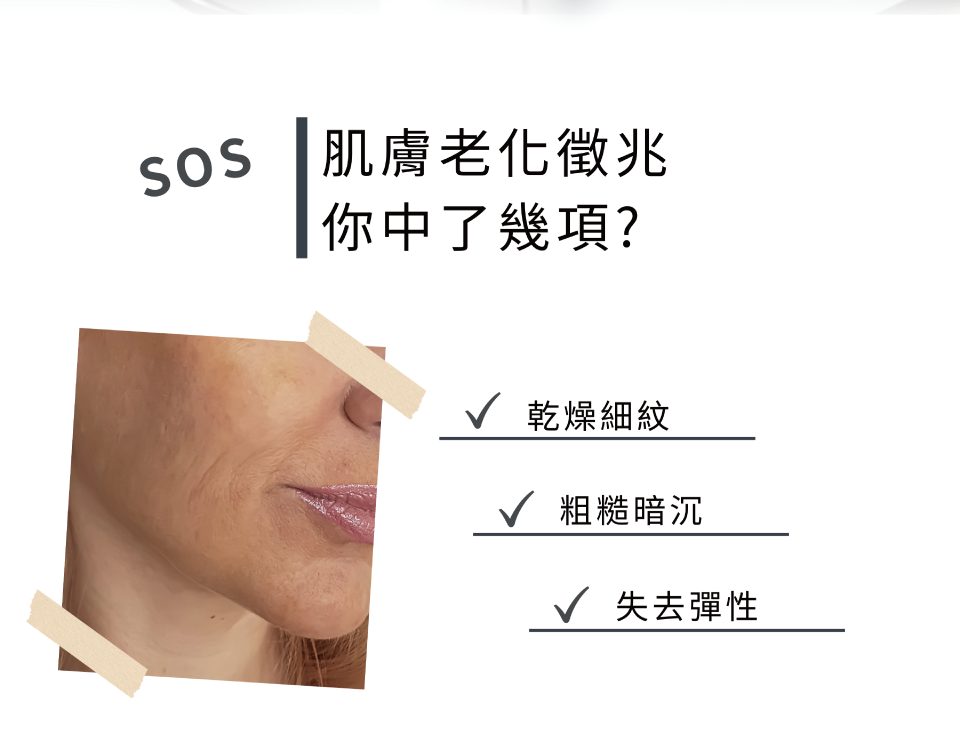 肌膚老化徵兆 你中了幾項?