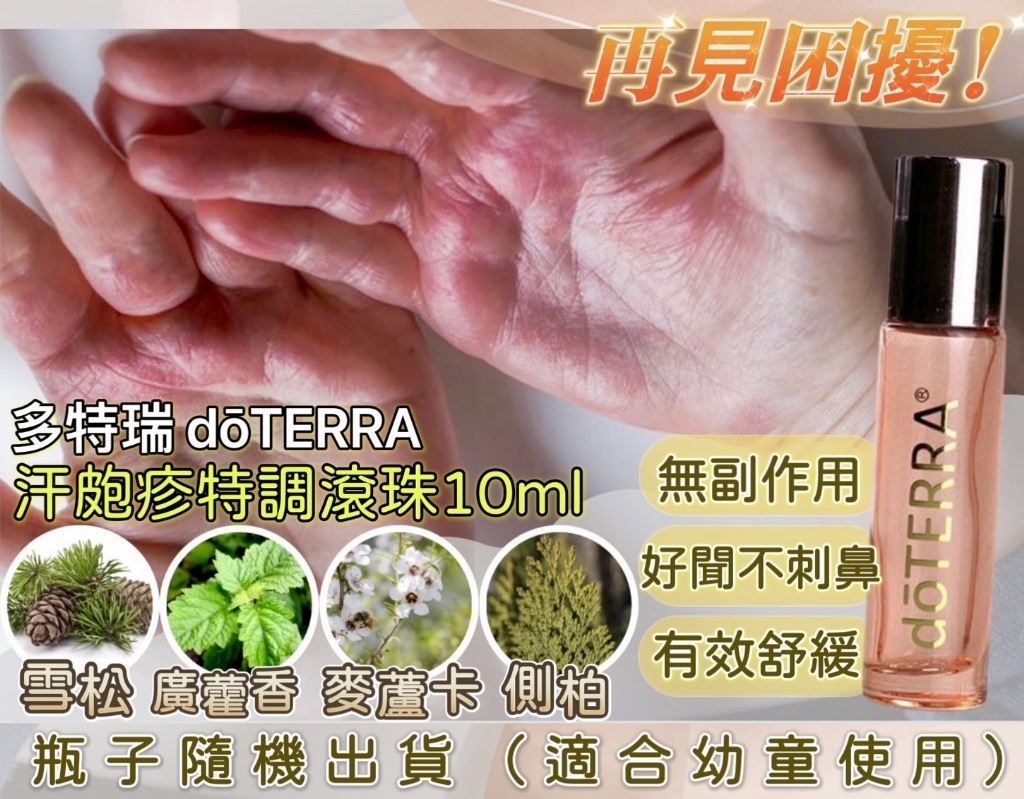 多特瑞doTERRA汗皰疹特調滾珠10ml