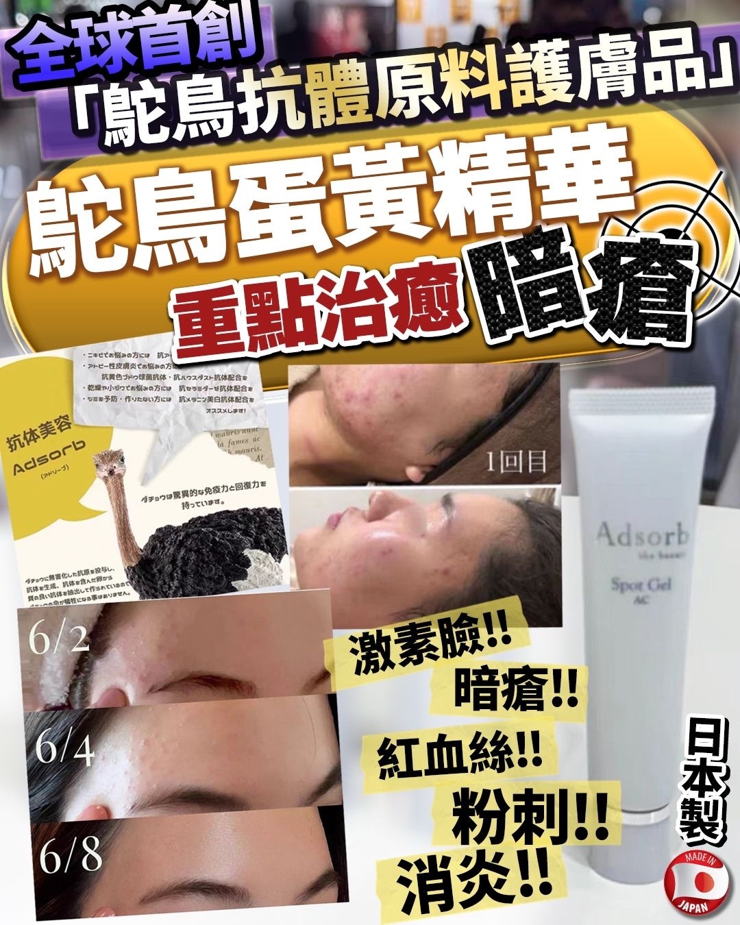 🥰日本 暗瘡終結者 25g