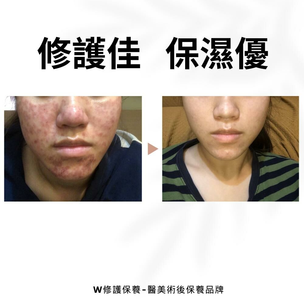 蝸牛特潤修護面膜