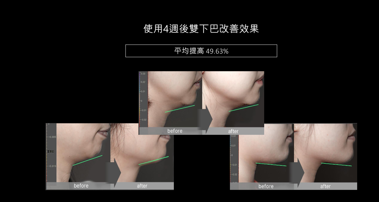 韓國院線產品 Effectra 全方位溶脂瘦身霜