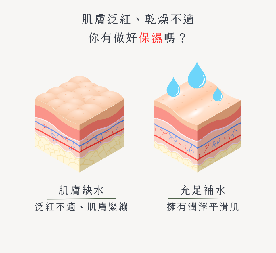 肌膚泛紅、乾燥不適 你有做好保濕嗎？