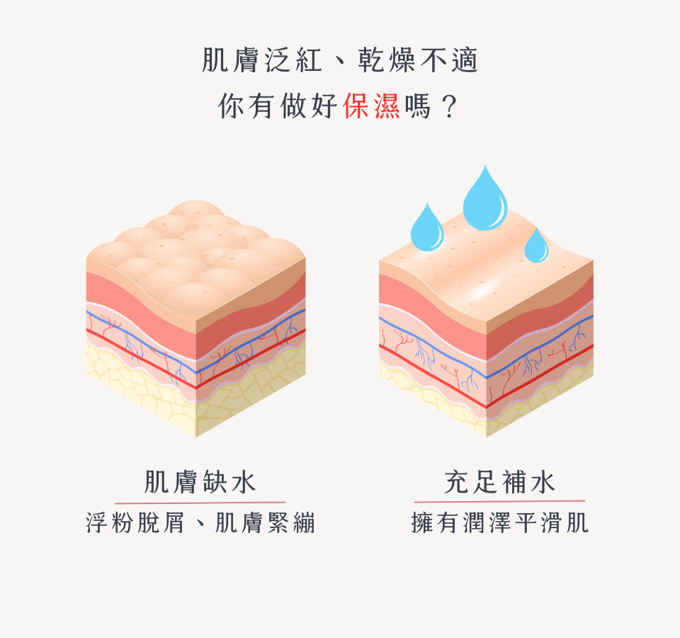 肌膚泛紅、乾燥不適 你有做好保濕嗎？