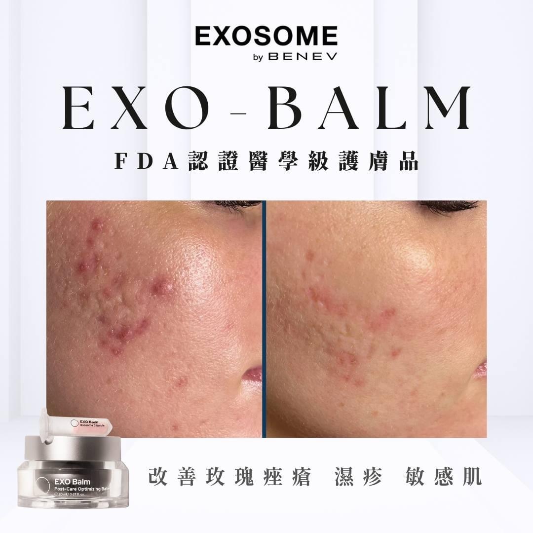 Benev EXO Balm•Exosome•雙重外泌體 外泌體抗敏保濕修復脂質