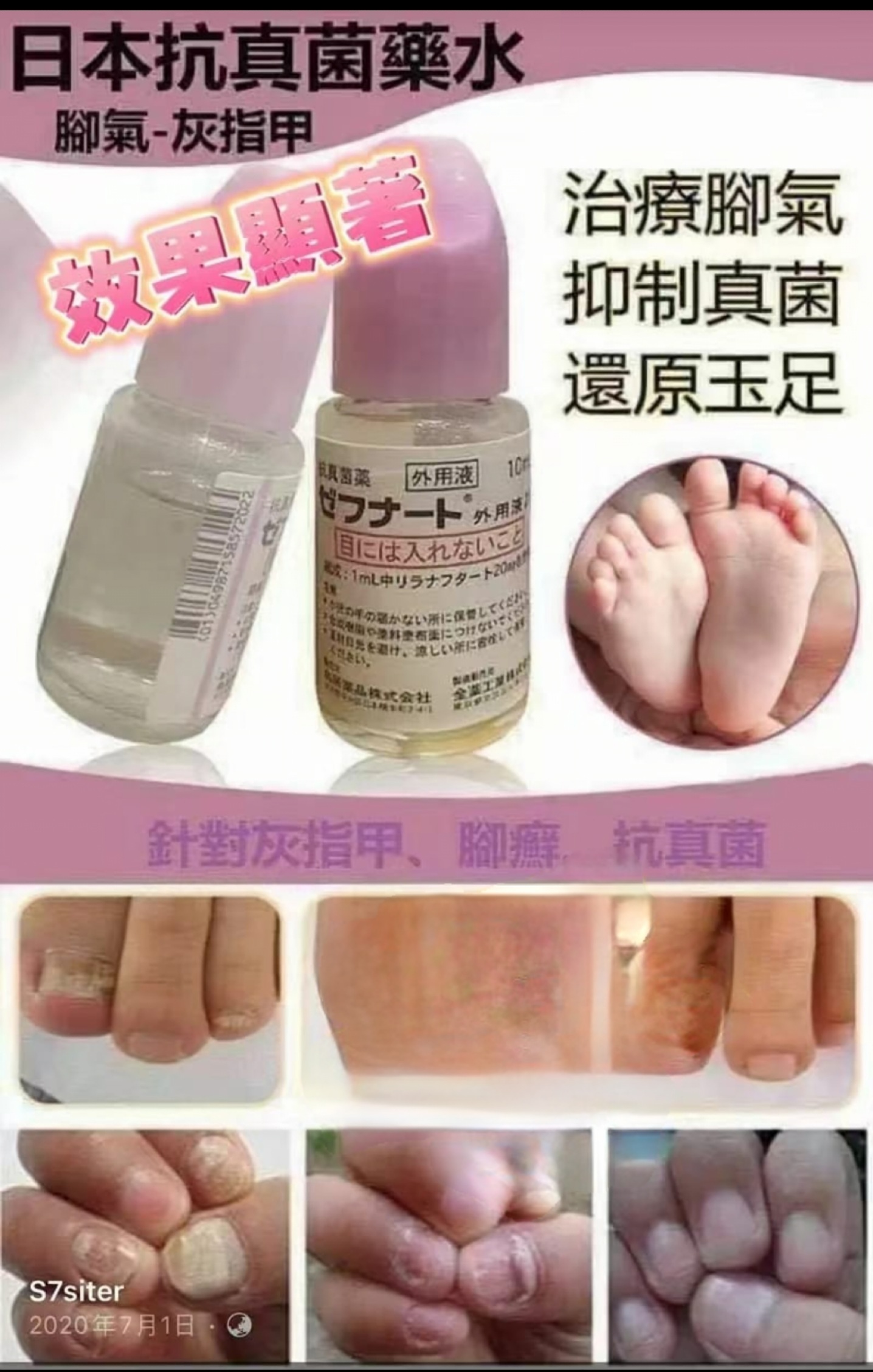 J3822  抗真菌藥水  $79/1 $150/2 $276/4