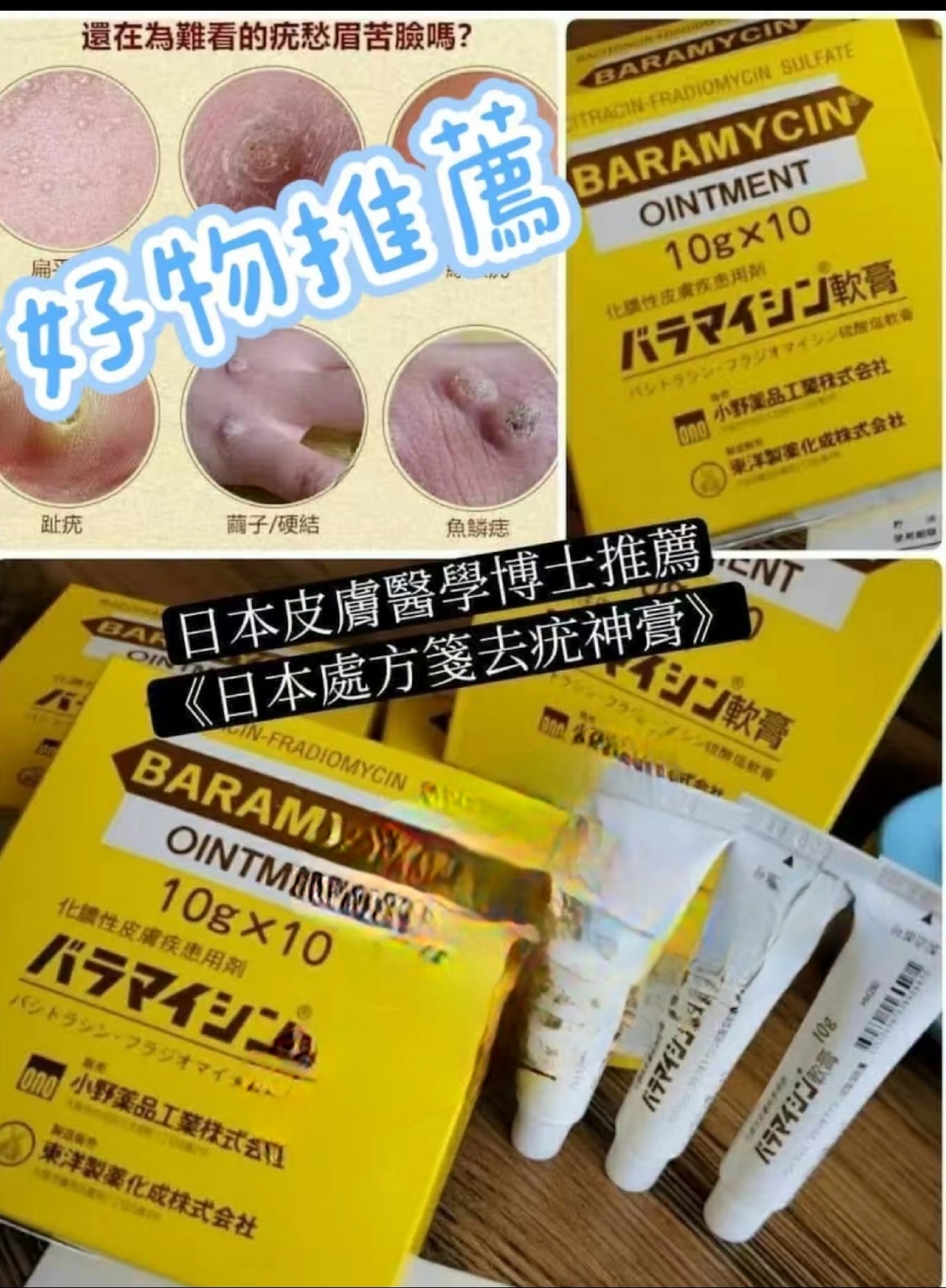 J3823  去疣神膏  $79/1  $225/3
