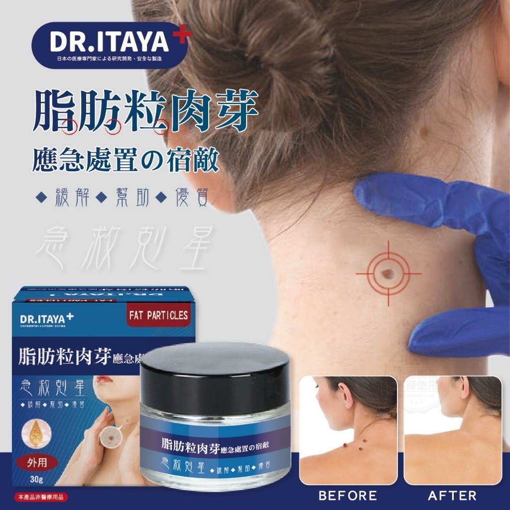 DR.ITAYA袪脂肪粒肉芽急救剋星30g