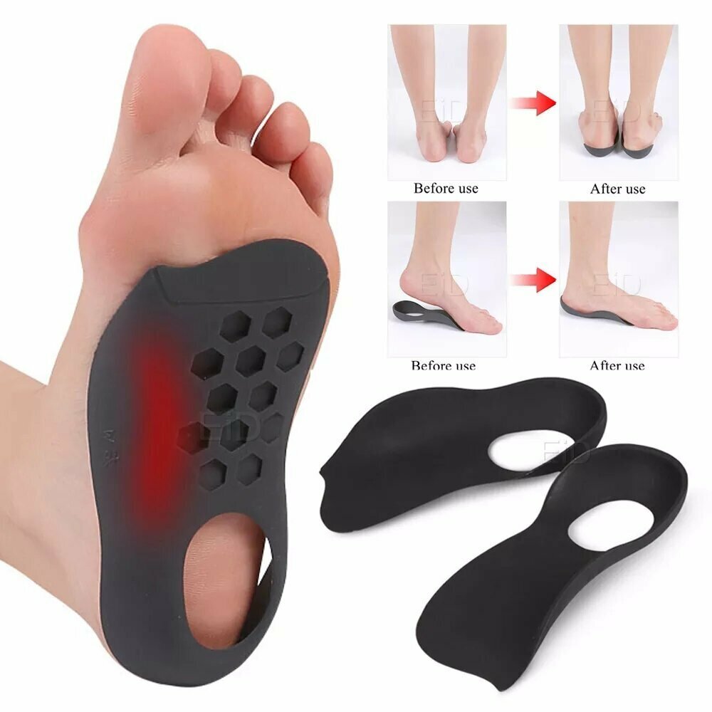 Popular model M 35-39 Japan's best-selling orthopedic insoles for flat feet, inflammatory foot valgus, plantar fascia, improved posture, O-leg support artifact