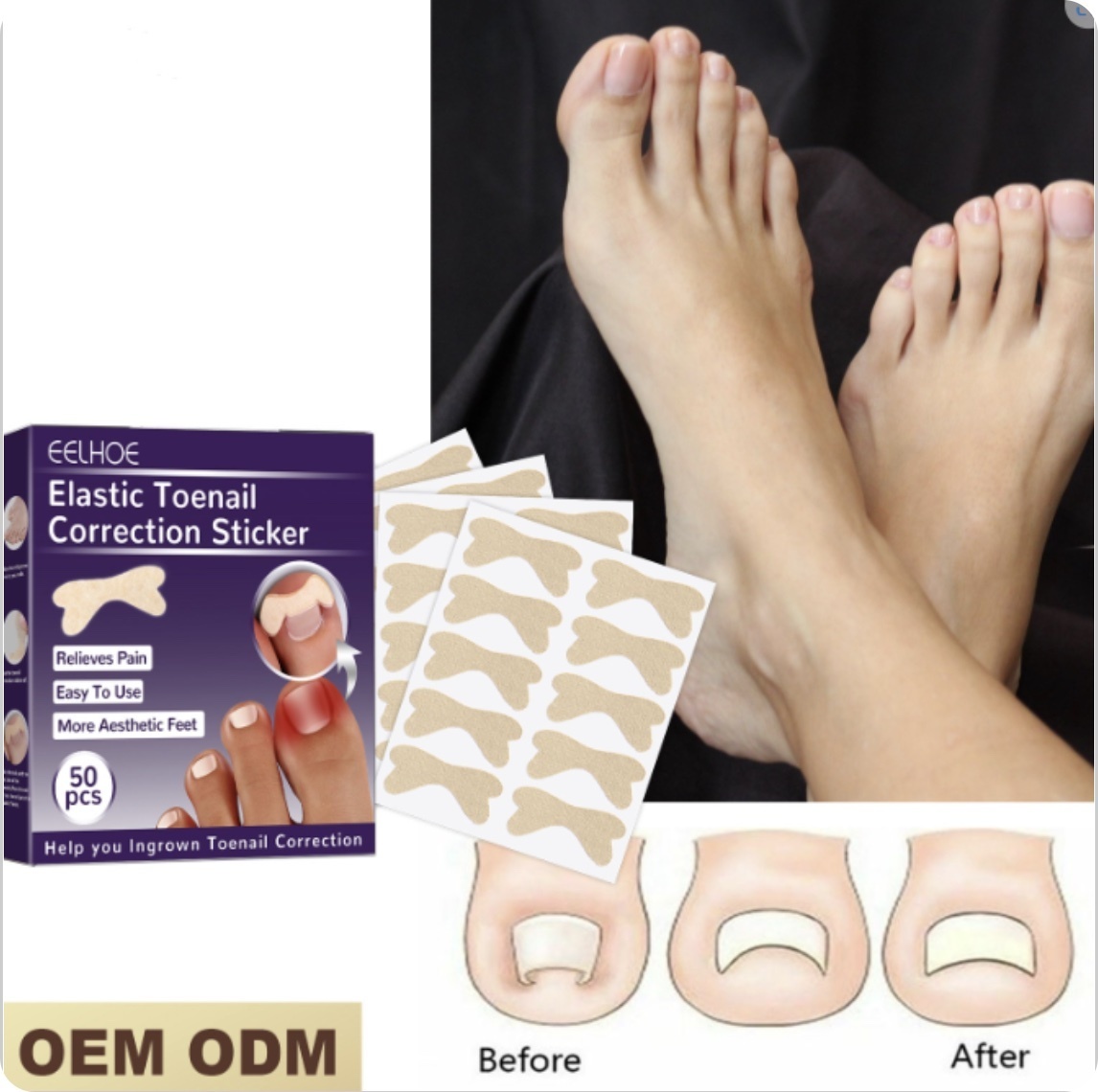 Popular toenail correction patches, manicure correction patches, ingrown toenail correction patches, ingrown toenail patches (50 patches)
