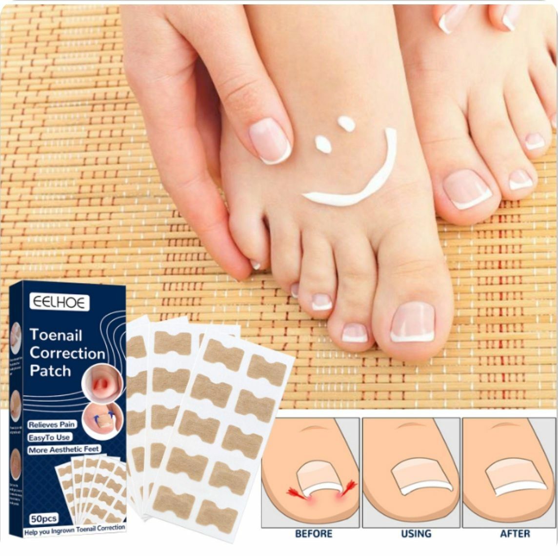 Popular toenail correction patches, manicure correction patches, ingrown toenail correction patches, ingrown toenail patches (50 patches)