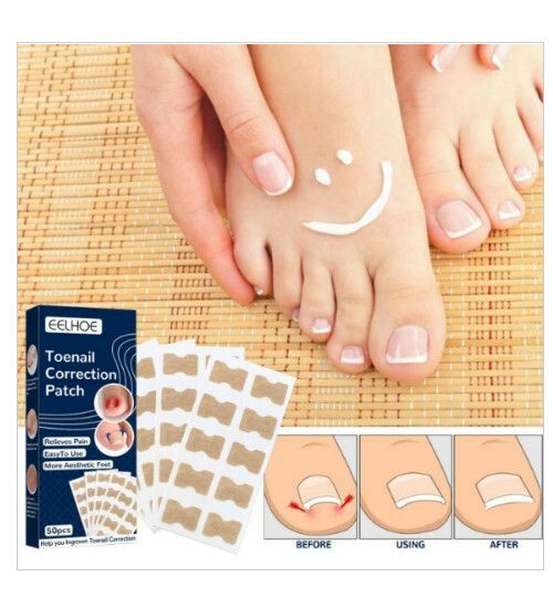 New toenail correction stickers, manicure correction stickers, ingrown toenail correction and repair stickers, ingrown toenail stickers (50 stickers)