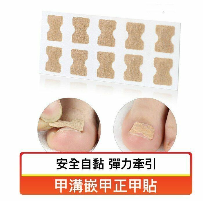 New 10-piece glue-free nail correction patch, toenail nail groove and ingrown nail corrector, pull-up patch pedicure tool, glue-free nail groove and ingrown nail correction patch, nail groove and ingrown nail correction patch, toenail patch, manicure patch, Owen Shopping