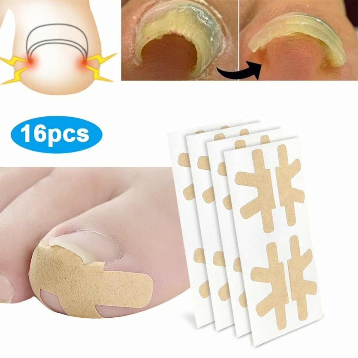 Hot sale 16 pieces (4 pieces x 4 sheets) Ingrown toenail soothing patch