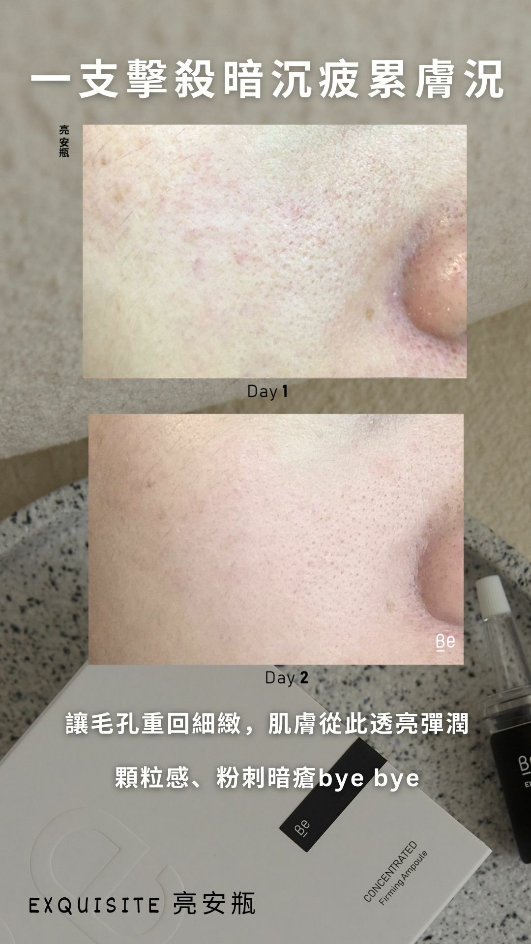 【細緻毛孔、亮澤肌膚美白淡斑】Be_ 亮安瓶