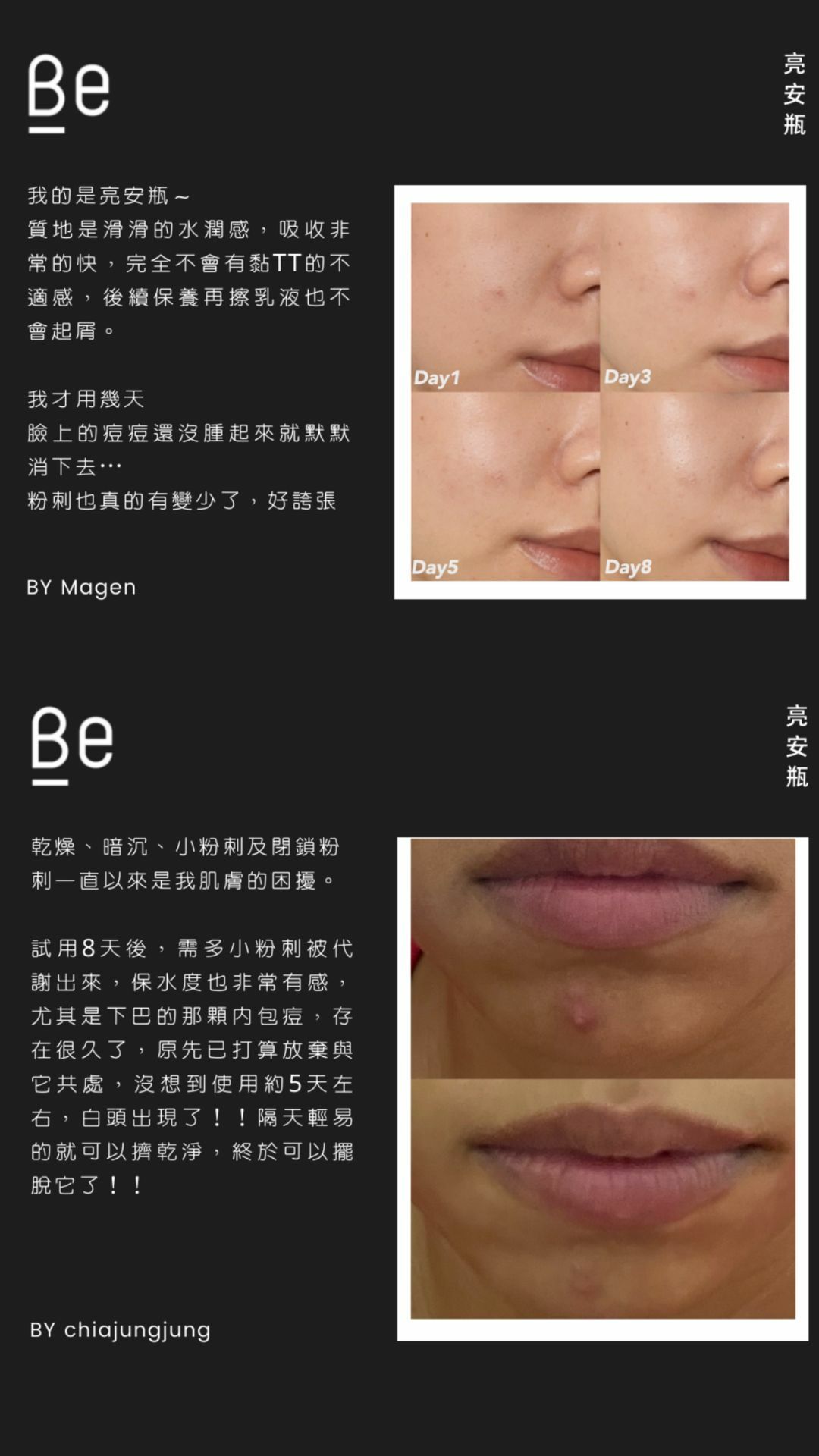 Be_ 亮安瓶試用裝