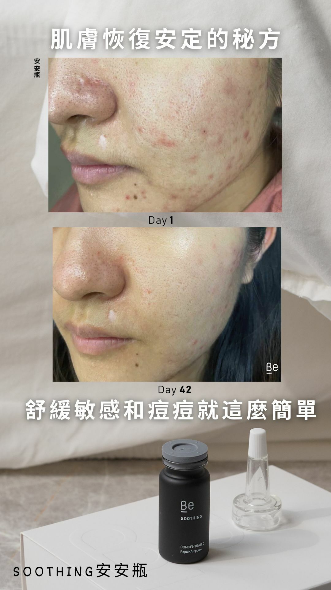 Be_ 安安瓶試用裝