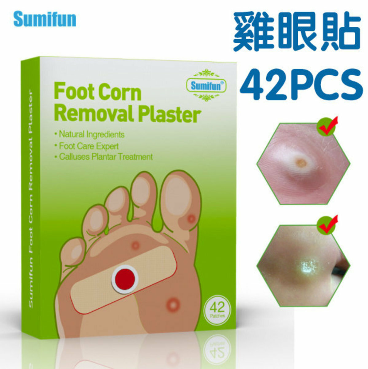 爆款(42片裝) Sumifun 第二代純天然雞眼貼 腳掌雞眼 無痛去除腳丁蹠疣老繭手繭腳繭
