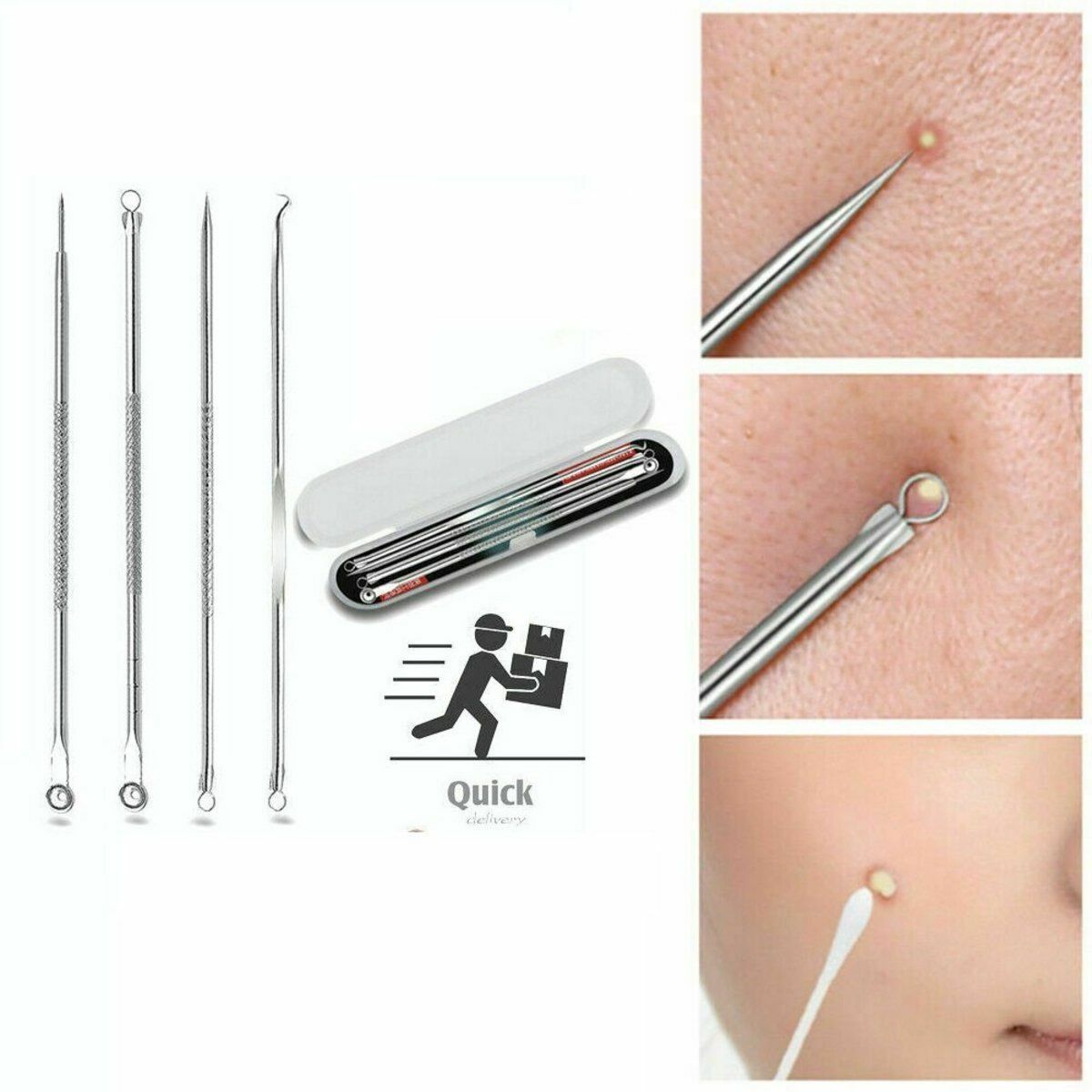 New (4 pieces) acne needle beauty beginner tool set, including acne needle, double-ended acne needle, acne clip, professional blackhead removal and acne needle tool set