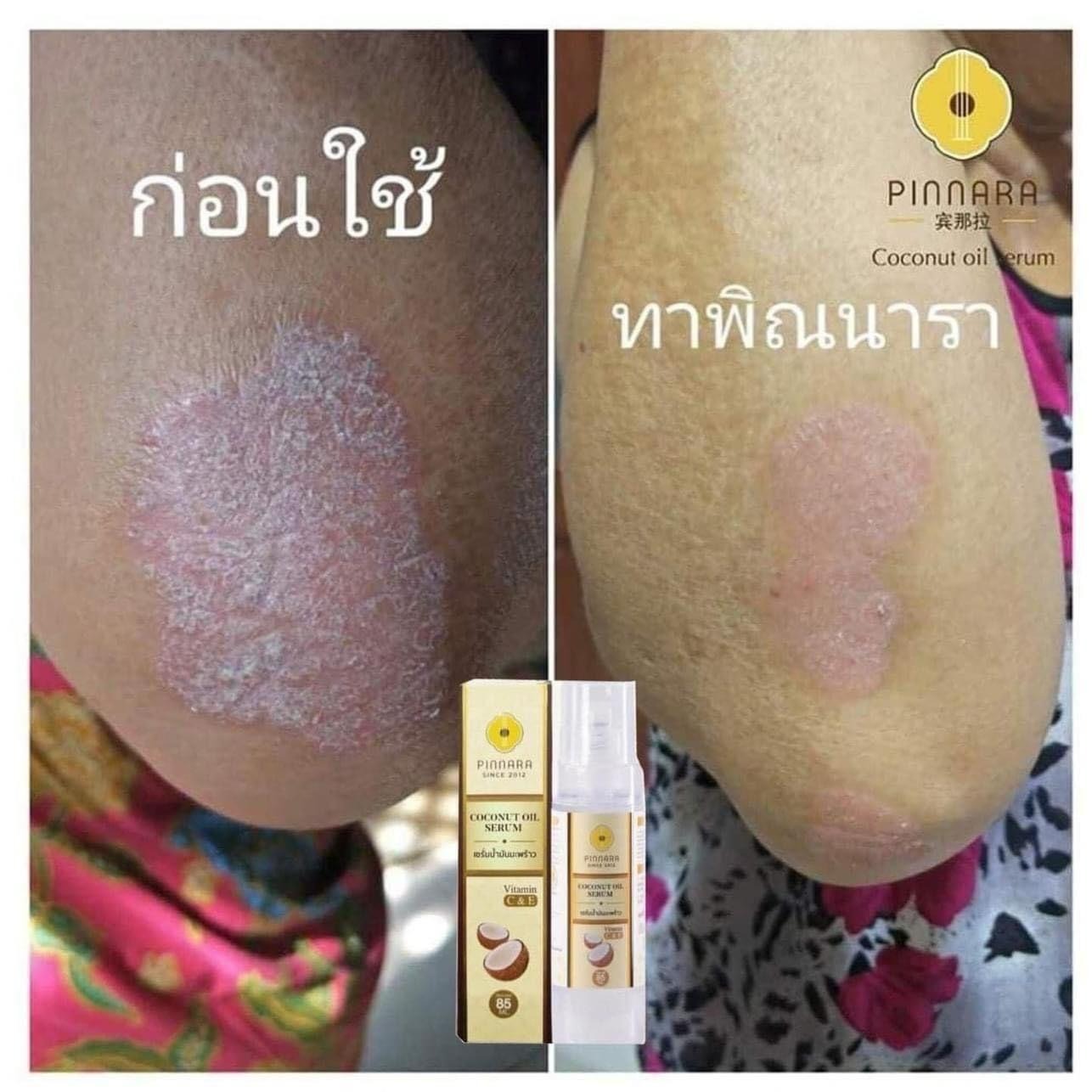 現貨 泰國🇹🇭PINNARA coconut oil Serum 椰子油精華液 85ml