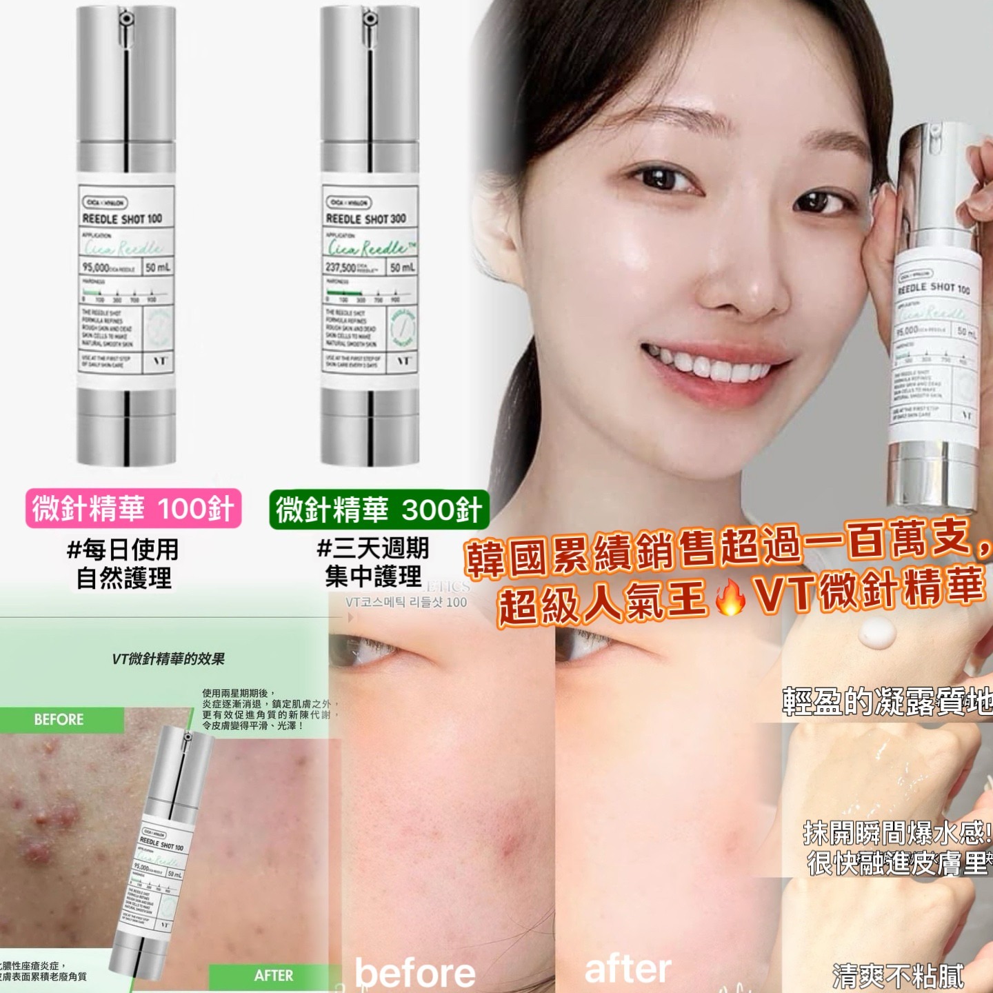 kc10408  韓國🇰🇷VT Reedle Shot Essence微針精華 50ml 100針/300針    100針: $169/支 $330/2 300針 $199/支 $390/2