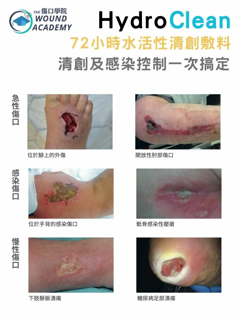 HydroClean 水活性清創除菌敷料 [現貨單片發售]