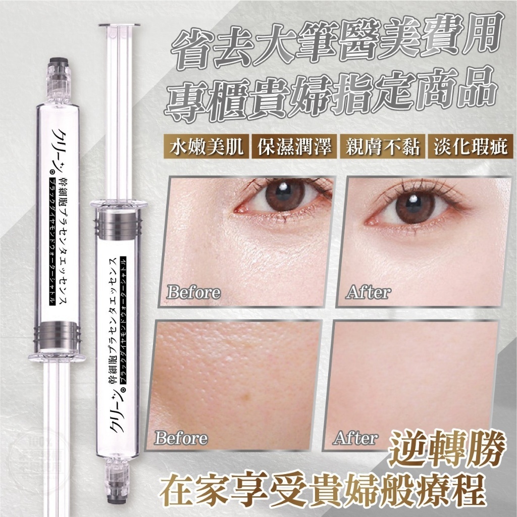 クリーン日本貴婦幹細胞胎盤精華黑鑽水飛梭10ml