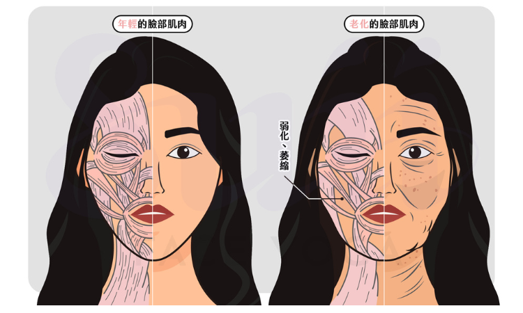 年輕與老化的臉部肌肉