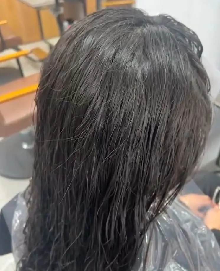 Severely damaged hair is prone to breakage, and the small fine hairs on the top of your head are actually broken strands.