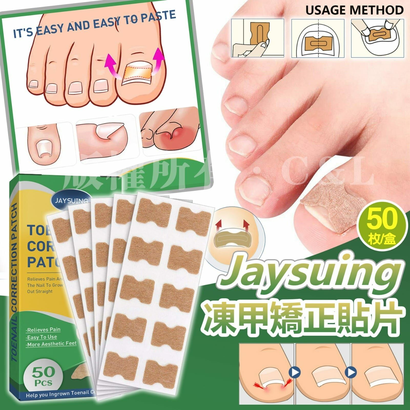 Jaysuing凍甲矯正貼片