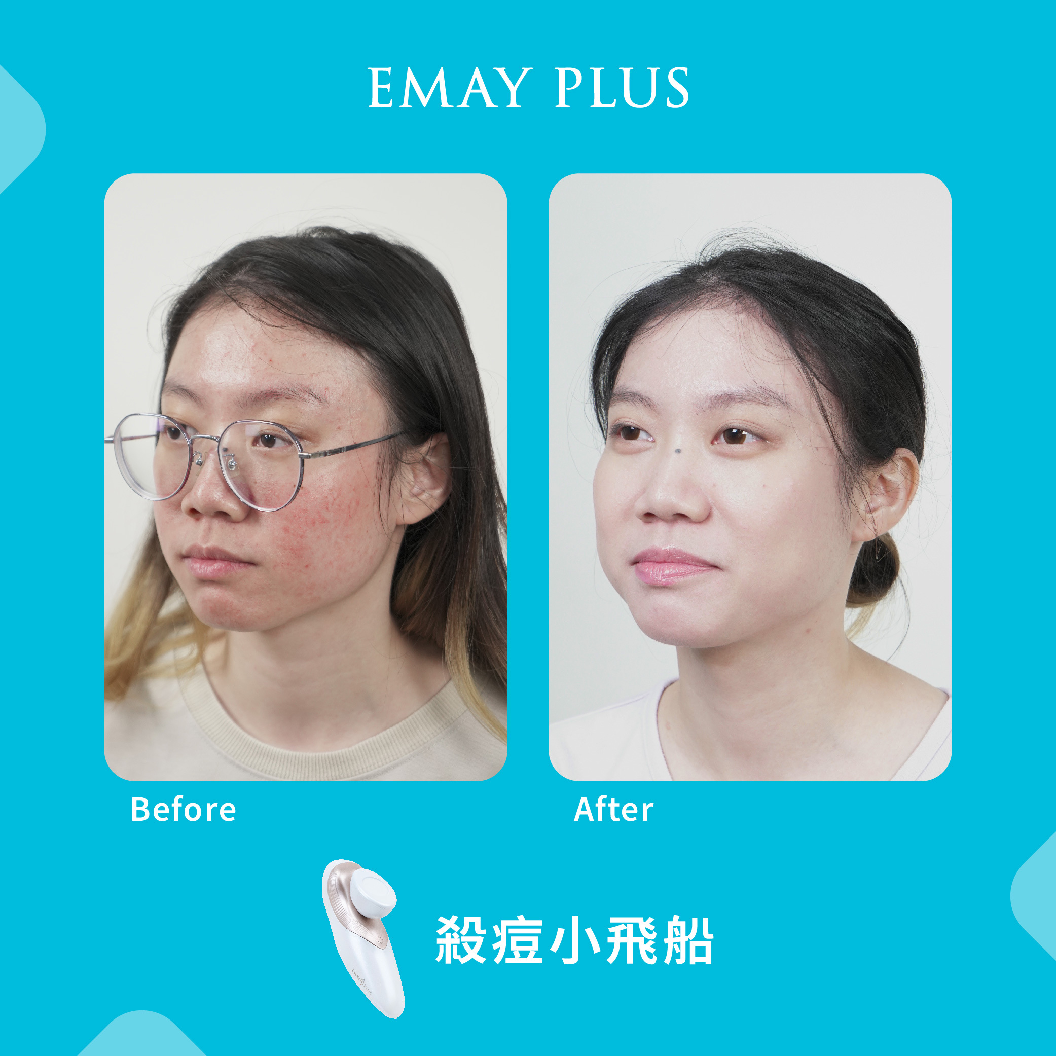 EMAY PLUS 美容儀器官網網店| 香港和澳門
