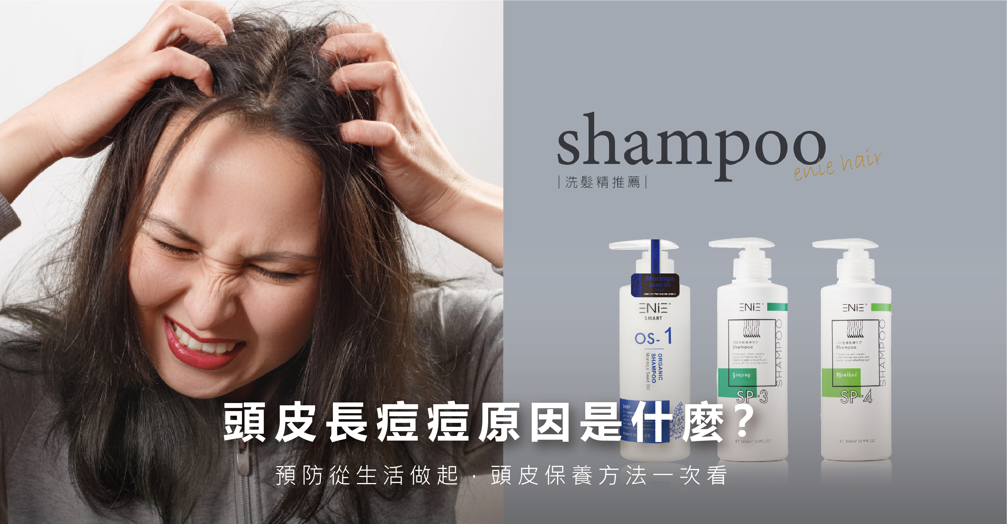 頭皮長痘痘原因,為什麼頭皮會長痘痘,護髮產品正確使用方法,頭皮洗髮精