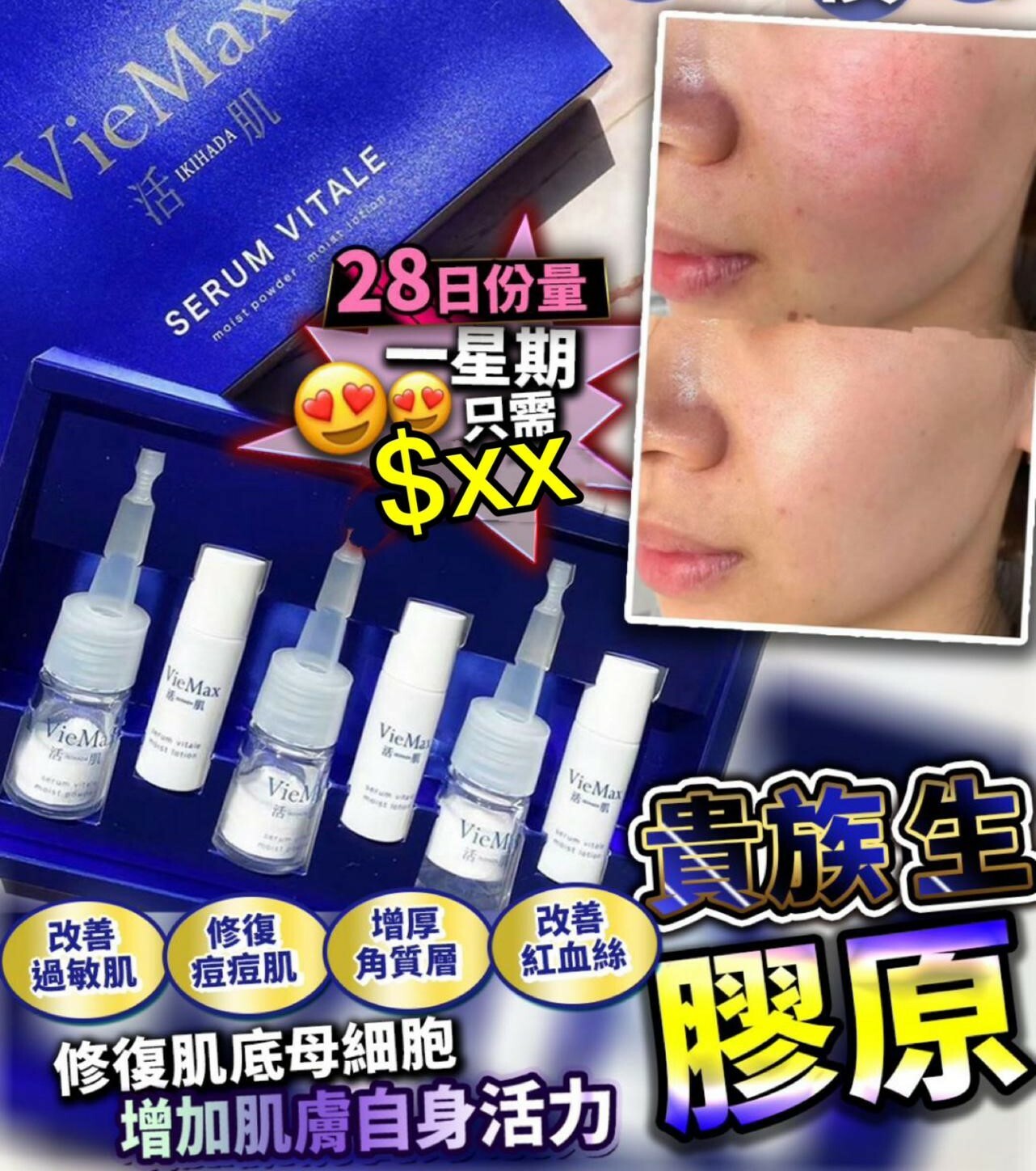 日本 vie max「貴族生膠原」3set