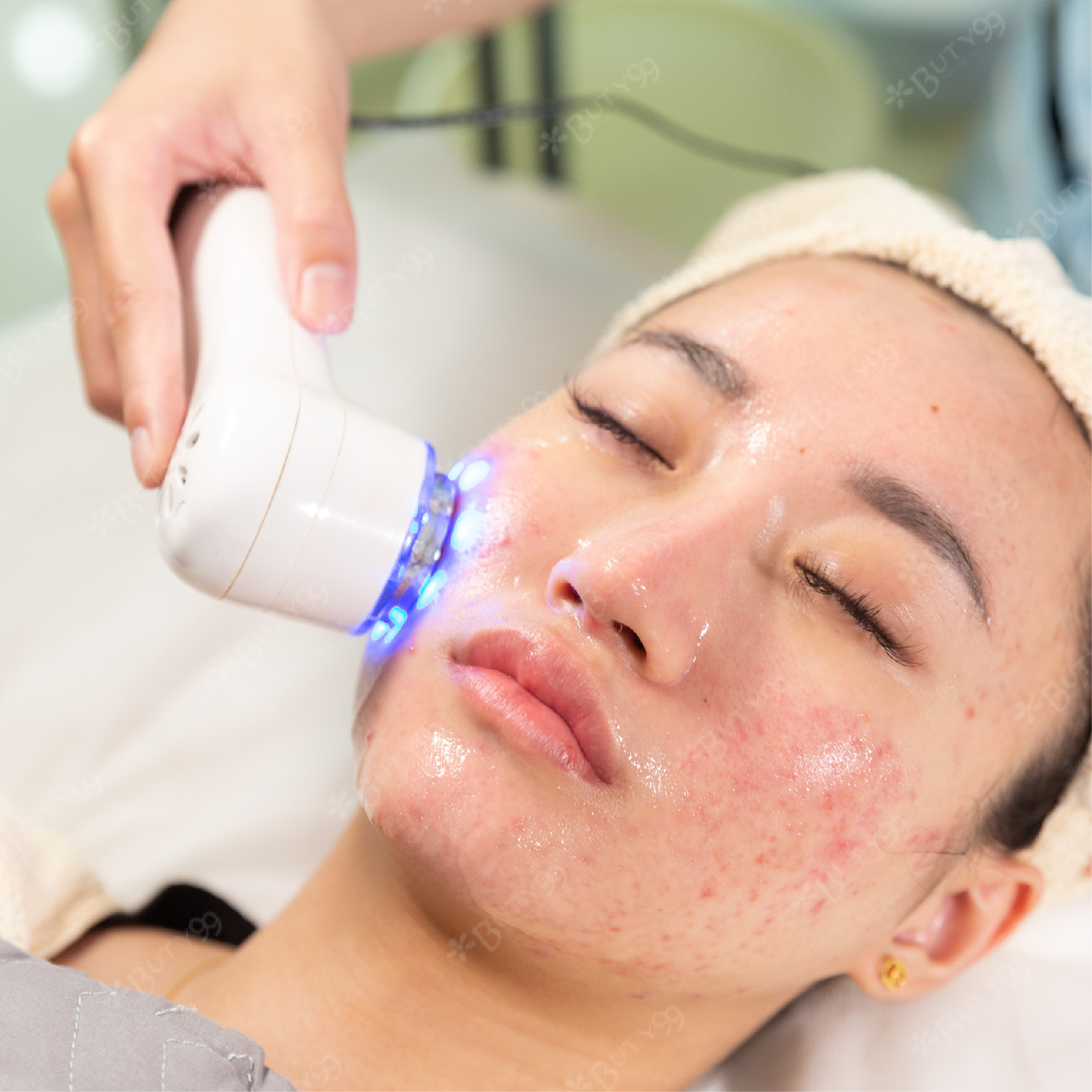 《中南部》零毛孔救星!高效海藻微針+鑽雕抗痘計畫,共兩次550元