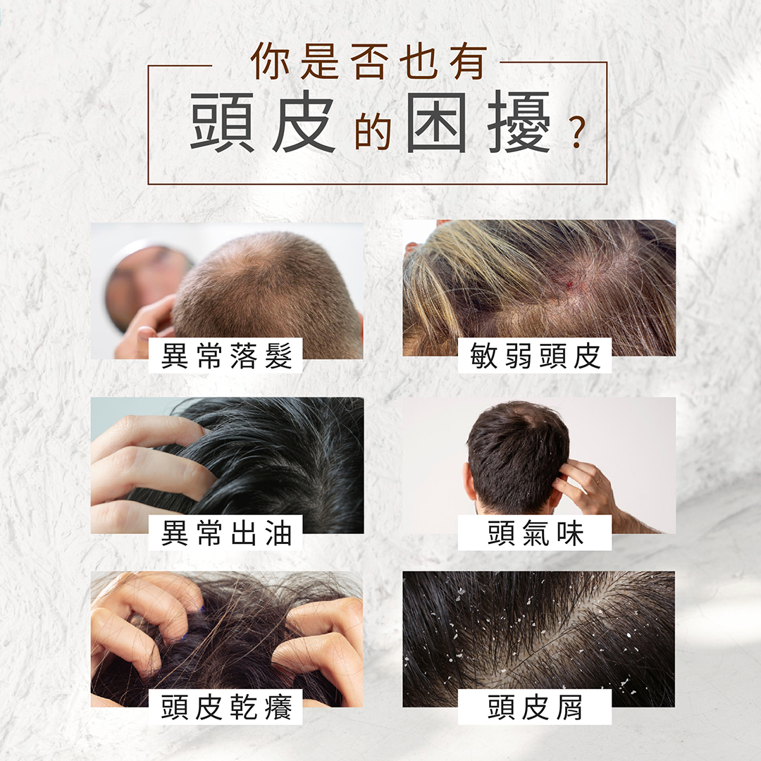 各種頭皮困擾