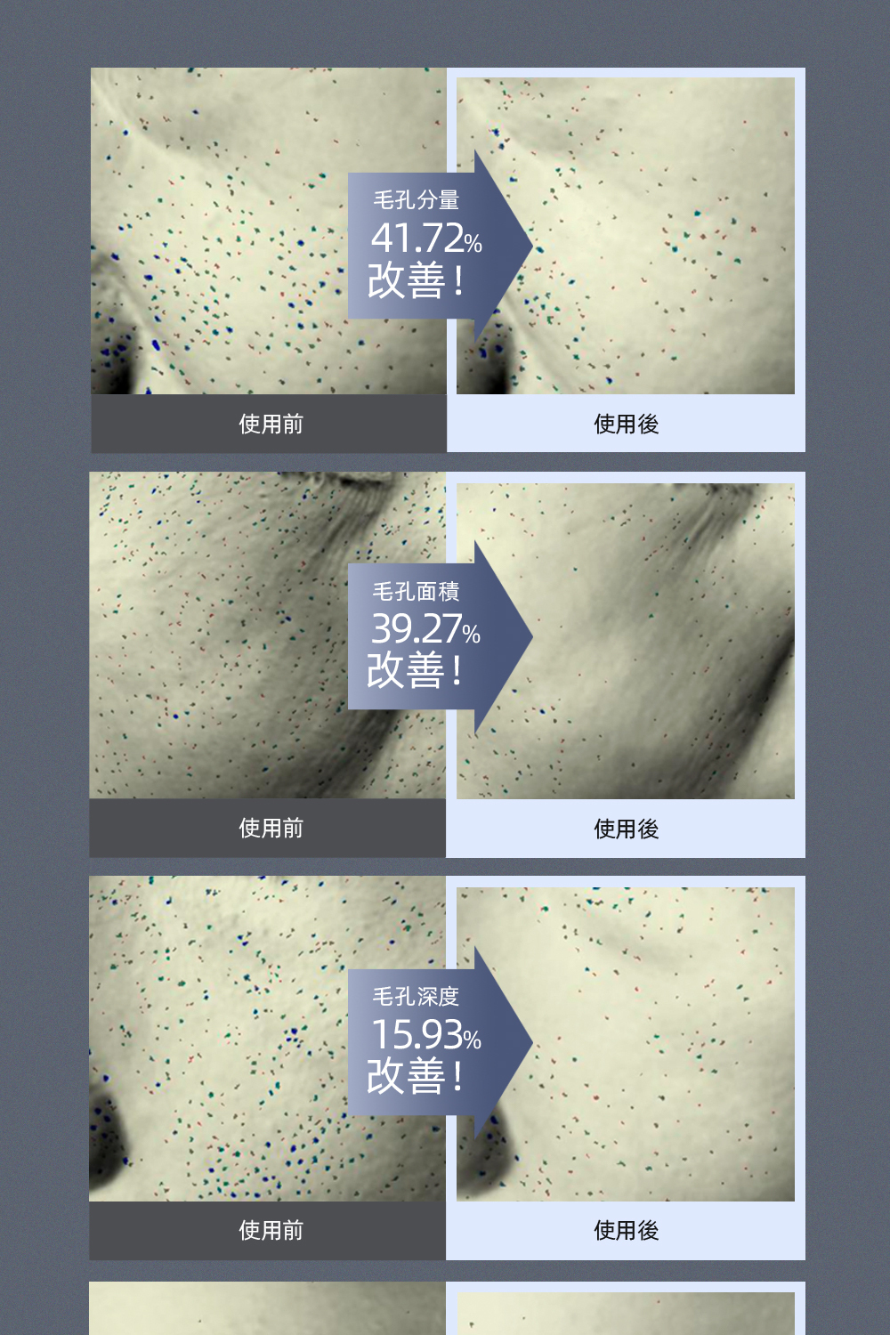 Luvum 修復毛孔泥漿面膜5片:深層清潔毛孔,修護肌膚,改善粗糙與毛孔問題,適合油性及混合性肌膚,有助於平衡皮脂分泌,讓肌膚更加細緻。