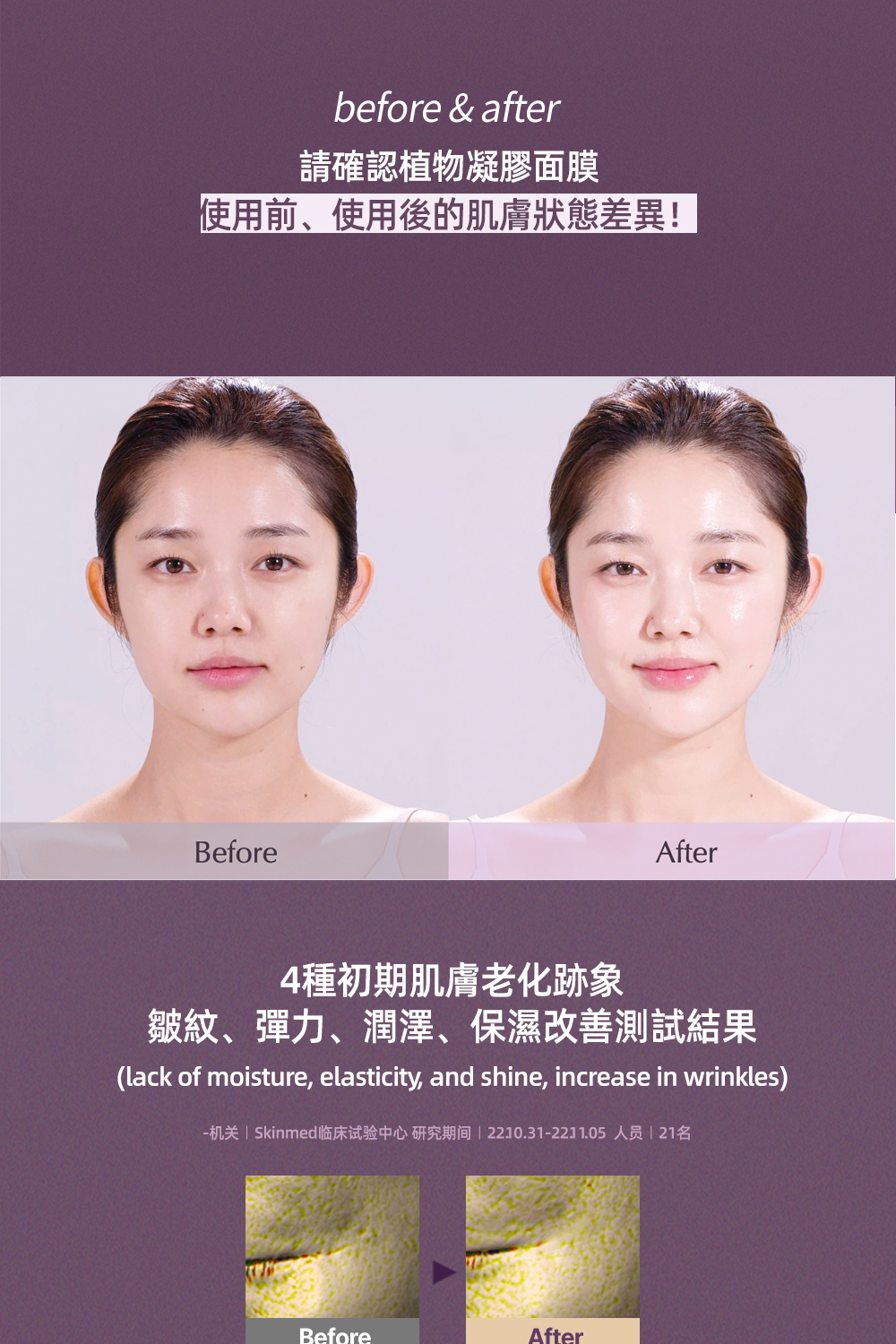 Luvum 植物膠原蛋白冰凝膠面膜5片:賦活肌膚,延緩老化,提供深層保濕與緊緻效果,有效提升肌膚彈性,讓肌膚更加光滑。